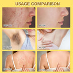 Bee Venom Skin Treatment Cream